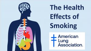 American Lung Association The Health Effects of Smoking